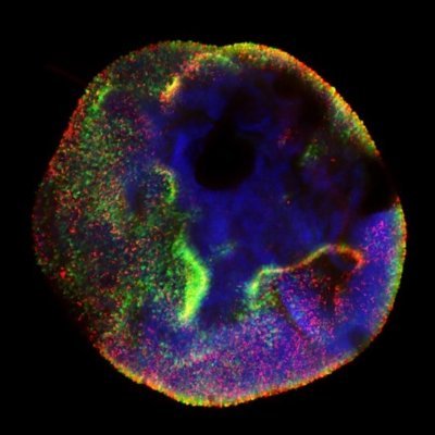 Stem cell-derived organoids to model eye, ear and brain diseases. Dr Anai Gonzalez Cordero leads the Stem Cell Medicine Group and Stem Cell & Organoid Facility.