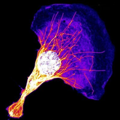 Using mainly immune cells, we try to understand how cells migrate, change shape and interact in tissues.
#immunecells #cellmigration

Run by lab members!