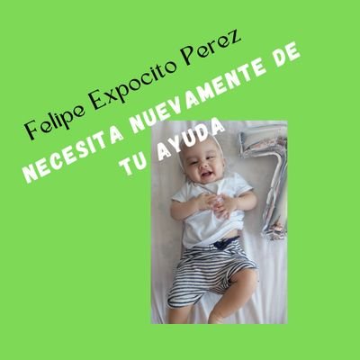 👶🏻 Hola ! Soy Felipe! 🇺🇾
Me diagnosticaron craneosinotosis
🆘 Necesito tu AYUDA ,para poder ser intervenido en Argentina 🏥
📞Eliana Pérez 091661799