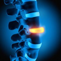 Urban Spine and Rehab (@spinepainfs) 's Twitter Profile
