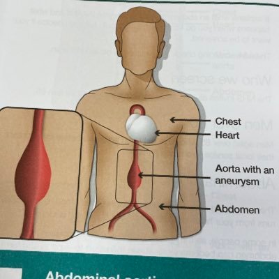 AAA Screening Leicestershire