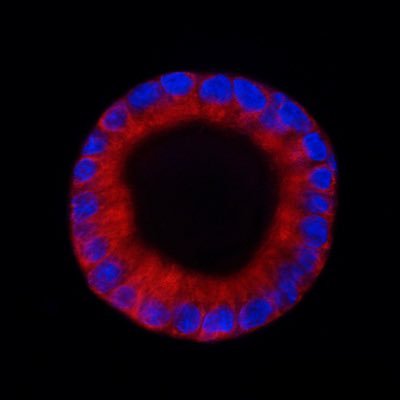 Absolutenivlek's profile picture. Postdoctoral Fellow (Shirihai lab)• Microscope enthusiast• Mitochondriac• Life-long learner•  Obsessed with Pinosomes and Alarmones•