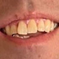 Beto's Teeth(@BetoTeeth) 's Twitter Profile Photo