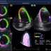 Cardiology Enthusiast (@cardiologyenth1) Twitter profile photo Cardiology Enthusiast (@cardiologyenth1) Twitter profile photo