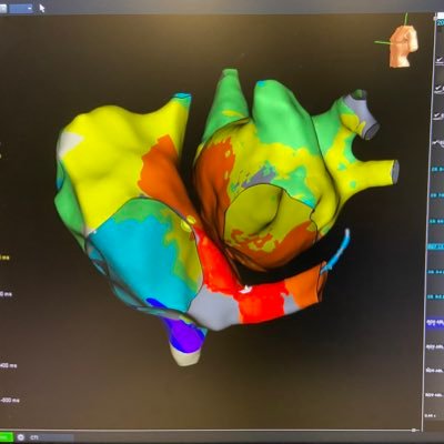 Abbott #EPeeps in the DC, Maryland, and Northern Virginia area. • Highlighting interesting cases and team adventures • #ProudToBeAbbott