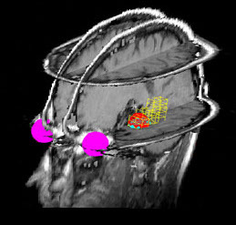 CancerDataOrg's profile picture. http://t.co/U1ByDZ5zhG is an open source driven web portal by Maastro Clinic (http://t.co/87maYvRhO8) that shares medical imaging data for cancer research.