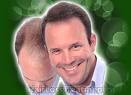 hairloss4's profile picture. Organin for hair loss is an inexpensive alternative to expensive hair transplants and hair treatment formulas.