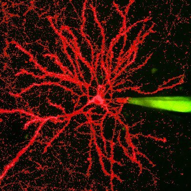 Wavefront engineering for the investigation of neuronal circuits.