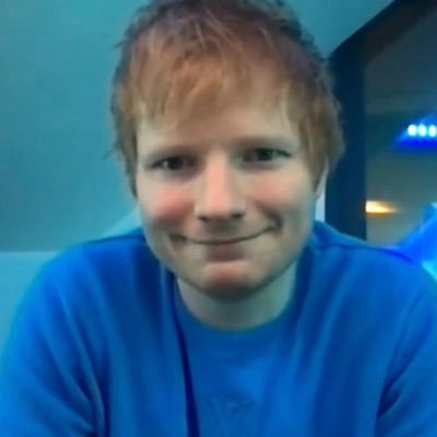 ~Edward Christopher Sheeran’s fluffy hair since 1991~ Wiggling 🍑