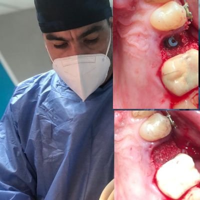 odontólogo, Mcs Cirugía Bucal, tígrero 100%, y con esperanza en que venezuela cambiara para mejor. Instagram @gamboajuanc