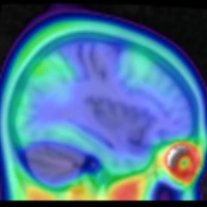 Mormino Lab Profile