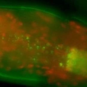 Extending the field of Fractones.
A resource for researchers working on fractones -dot extracellular matrix structures- and their role in health and disease.