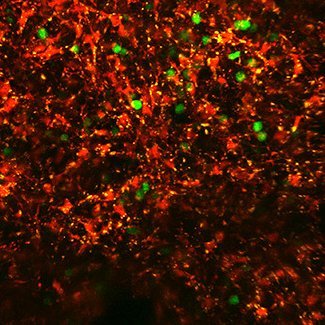 FooksmanLab's profile picture. Fooksman Lab (AECOM) focuses on plasma cell biology, multiple myeloma, cellular immunology, in vivo imaging and more!