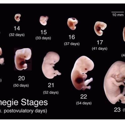 I bring to you the beautiful science of early human development and embryology. Stay glued!