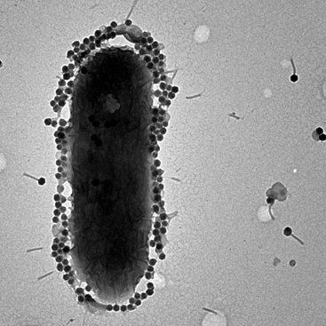 Phages from nature to patient's bed!

Ran Nir-Paz, Hadassah Medical Center
Ronen Hazan, The Hebrew University