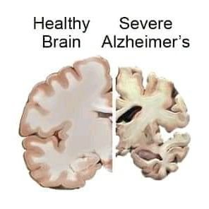 Ak0007777's profile picture. Yes but no