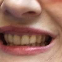 Forelle πΊπ¦πΈπ»π (@hfrominger) 's Twitter Profile