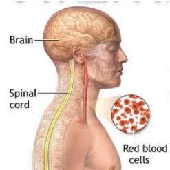 Over B12/cobalamine deficiëntie want daarin is een enorm kennishiaat waardoor veel misdiagnoses, onnodig leed en veel kosten. Soms aandacht voor LC en ME etc.