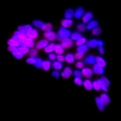 PhD, #StemCellResearch 🧫 Foodie 🍰, nature lover 🐼, traveler 🌍, #INFJ 🧚🏽♀️