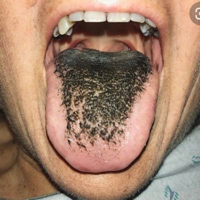 Your tongue belongs in an asshole. No one wants to see your stupid tongue. #fuckmileyforthat