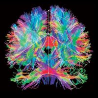 The Krembil Centre for Neuroinformatics (@camh_kcni) 's Twitter Profile