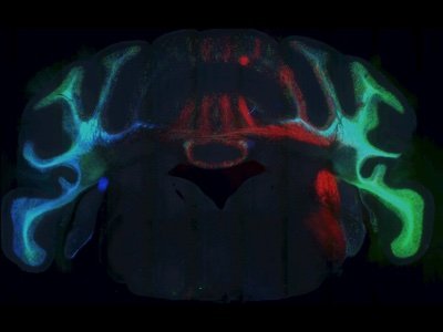 Custom viral vectors for Neuroscience. Supported by UNC Neuroscience Center and the BRAIN Initiative.