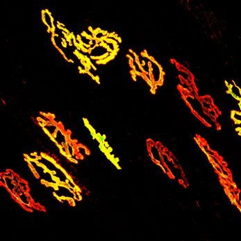 Directed by Dr JP Henríquez 🇨🇱 the NeuroMuscular Studies Lab (NeSt Lab) is mainly focused on the role of early morphogens to maintain/repair the damaged NMJ