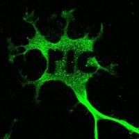 Plateforme d'Imagerie Cellulaire du CRCHUM (@crchum_cells) 's Twitter Profile