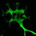 Plateforme d'Imagerie Cellulaire du CRCHUM (@crchum_cells) Twitter profile photo Plateforme d'Imagerie Cellulaire du CRCHUM (@crchum_cells) Twitter profile photo