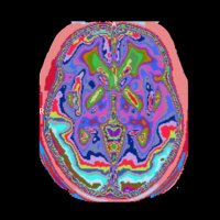 HVL Radiography (@hvl_radiograf) 's Twitter Profile Photo HVL Radiography (@hvl_radiograf) 's Twitter Profile Photo