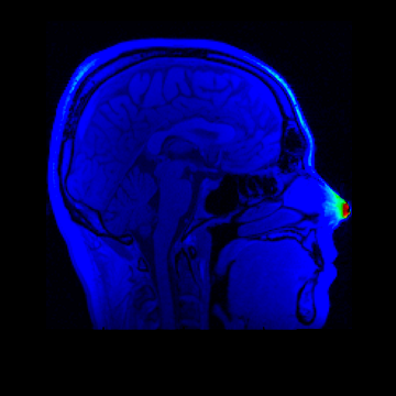 Professor for Machine Learning and Computer Vision at @ISTAustria. @ELLISforEurope Unit Director. Yes, this is my actual brain in the scan.