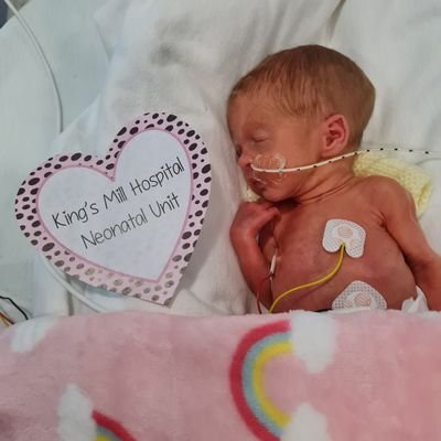 🌳Neonatal Unit at Sherwood Forest Hospitals - Level2 (@SFHFT) 🏥12xNeonatal Beds & 6xTransitional Care Beds 🌈❤Supported by the Emily Harris Foundation Charity