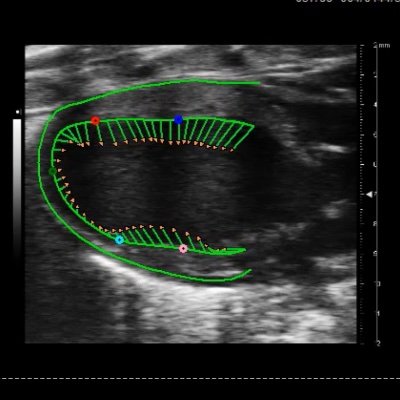 Center of multi-disciplinary scientists striving to uncover the mysteries of the cardiovascular system. Website: https://t.co/D8zQL97zXk