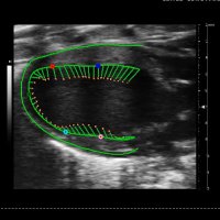 Center for Cardiometabolic Science (@cardiometabosci) 's Twitter Profile Photo Center for Cardiometabolic Science (@cardiometabosci) 's Twitter Profile Photo