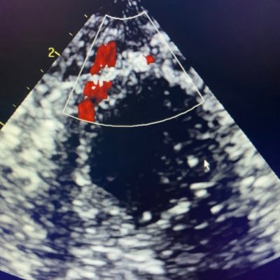 Shemy Carasso MD, FESC, FASE Profile