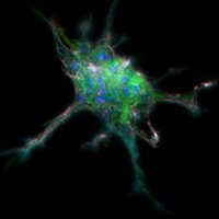 Dr. Diego Sepulveda-Falla Lab (@diegosflab) 's Twitter Profile Photo Dr. Diego Sepulveda-Falla Lab (@diegosflab) 's Twitter Profile Photo