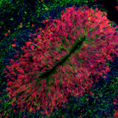 Kang Berg Lab @aberdeenuni, Brain organoids, Neurodevelopment, Neurogenesis, Neurodegeneration, Neuroimmunology. Aberdeen, Scotland 🏴󠁧󠁢󠁳󠁣󠁴󠁿 🧠