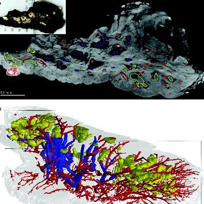 We study #Mycobacterium #tuberculosis #Immunometabolism #Gasotransmitters #Bioenergetics #LungImaging #HostDirectedTherapies 
@AHRI_News & @UABMicrobiology