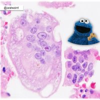 Oral Pathology 'Weird & Wonderful'(@OralWeird) 's Twitter Profile Photo Oral Pathology 'Weird & Wonderful'(@OralWeird) 's Twitter Profile Photo