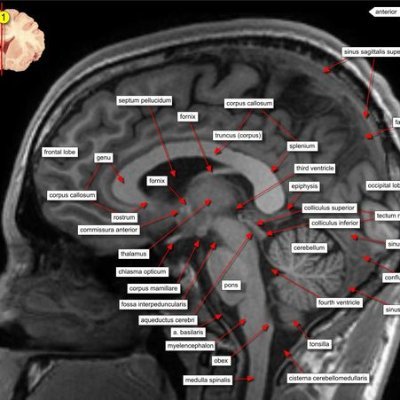 dr_venky92's profile picture. MBBS,  MD Radiodiagnosis
