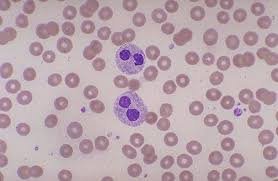 ZiadHab13893248's profile picture. Hemepath ❤️