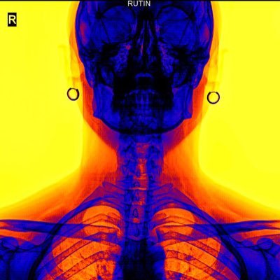 emrekapcak's profile picture. Lens Based Visual Artist / Fashion Photographer / https://t.co/LlN7nXaQoP