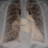 Kristopher Cummings, MD (@cummingsrad) 's Twitter Profile Photo Kristopher Cummings, MD (@cummingsrad) 's Twitter Profile Photo