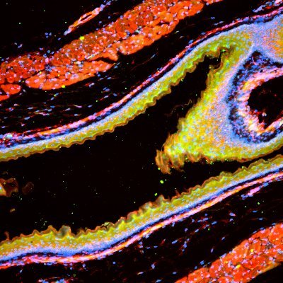 NIH Funded UO1 Consortium to Discover & Validate Pre-Clinical Models of Idiopathic Pulmonary Fibrosis