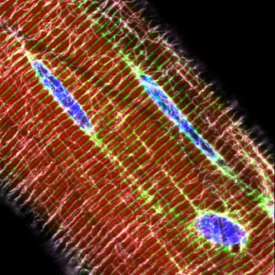 We are a research group in @amsterdamumc Department of Physiology focusing on studying skeletal muscle mechanobiology and aging.