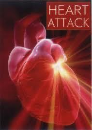 Articles of Heart Attack Symptoms and Cure