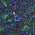 Neuroinfections Lab (@neuroinfections) Twitter profile photo Neuroinfections Lab (@neuroinfections) Twitter profile photo