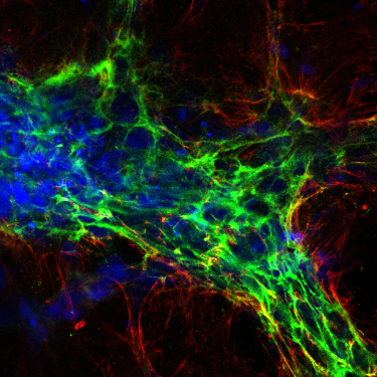 Tumour microenvironment research lab. We are interested in understanding the composition and function of the extracellular matrix in immunosuppression.