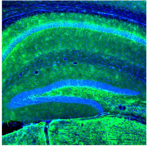 euroepinomics's profile picture. EuroEPINOMICS - Functional genomic variation in the epilepsies - Collaborative Projects on epilepsy genetics by the European Science Foundation (ESF)