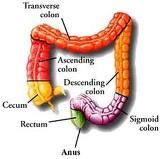 Latest Research and Information on Colon Rectal Cancer diseases